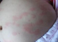 �������ߺ�ݡ����